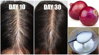 How To Grow Long \& Stop Hair Fall With Onion \& Egg|Magical Hair Growth Treatment 100% Works