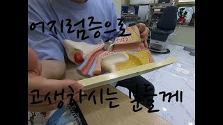 이석증 어지럼증 메니에르로 고통받는 우리집 여자들의 선택 (feat. 박진복이빈후과)