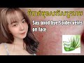 មូលហេតុនឹងវិធីព្យាបាលមុខសរសៃក្រហម| causes and treatments of broken blood vessels on the face