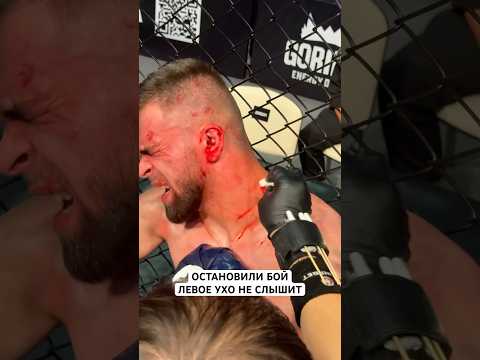 Левое ухо не слышит #ufc #файтинг #nfc #mma #бокс #naiza #юфс #sports #ухо #нокаут #травма #казах