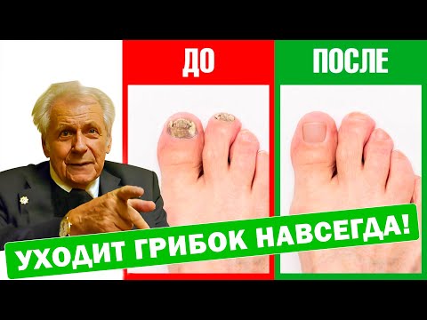 Секрет Неумывакина: Избавьтесь от грибков, вирусов и бактерий!