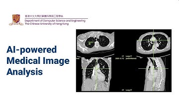 AI-powered Medical Image Analysis