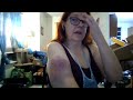 24 hours post bus accident with reckless driver