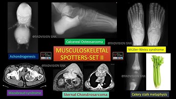 MUSCULOSKELETAL SPOTTERS SET II