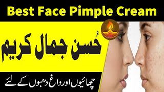 Chehre per Daag Dhabbe khatam karne ki Cream | Husn e Jamal Cream | Face Beauty Cream Tips