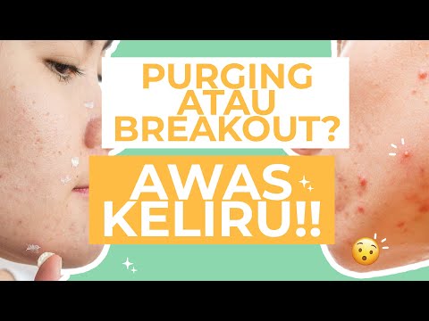 Awas Keliru! Beda Purging dan Breakout Serta Cara Mengatasinya