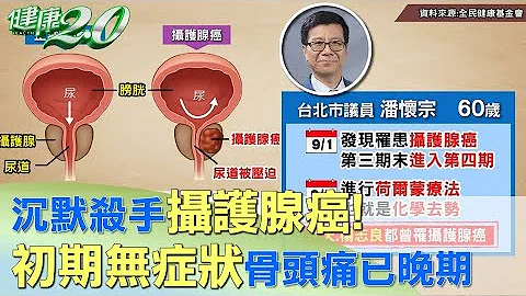 沉默杀手摄护腺癌！ 初期无症状骨头痛已是晚期 健康2.0 - 天天要闻