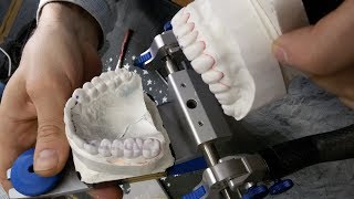 Ваксап моделирование зубов из воска #Waxup