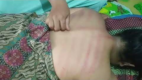 Pijat wanita,kerokan wanita masuk angin terbaru,❗edisi lebaran