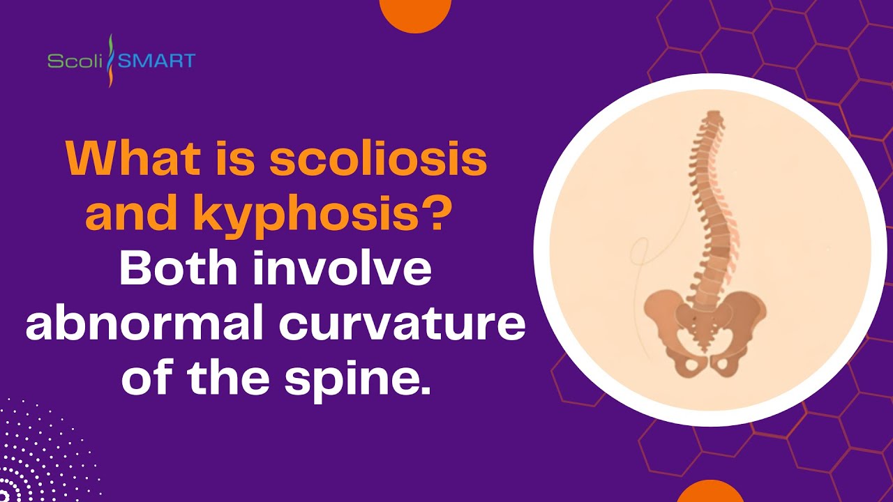 What is scoliosis and kyphosis Both involve abnormal curvature of the spine 