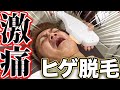 徹底ヒゲ脱毛!地獄の無麻酔フルコース体験第二弾!【脱毛サロン】