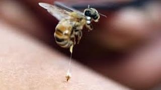 Que picadura causa en las de piernas dolor abeja