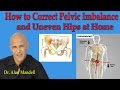 How To Correct Pelvic Imbalance and Uneven Hips at Home - Dr Mandell