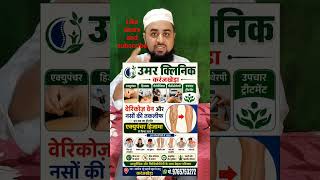 Varicose veins  वेरिकोज वेन #vairalvideo #physiotherapist #acupuncture
