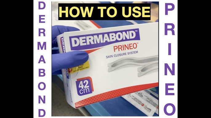 Step-by-Step Guide for Effective Application of DERMABOND PRINEO Skin  Closure System
