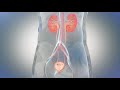 Expel™ Nephroureteral Stent Procedure   Animated Demonstration