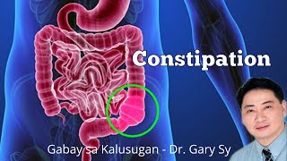 constipation - dr. gary sy