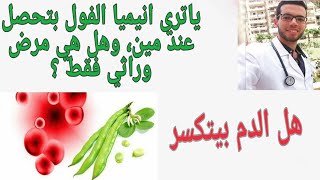 اعراض انيميا الفول | اسباب حدوث انيميا الفول| favism