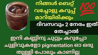 Remove Dark Circles |എത്ര പഴക്കം ചെന്ന കണ്ണിനു ചുറ്റുമുള്ള കറുപ്പും Pigmentation ഉം നിസാരമായി മാറും