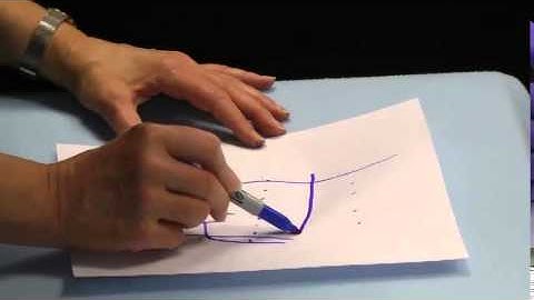 Constructing an Effective Intrinsic Stretching Orthosis Preview