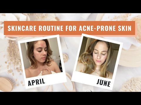 My Morning and Night Skincare Routine for Acne-Prone Skin | Lucie Fink