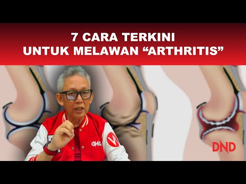 Video: 3 Cara untuk Tetap Positif ketika Anda Menghidap Artritis