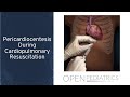 "Pericardiocentesis During Cardiopulmonary Resuscitation" by Traci Wolbrink for OPENPediatrics