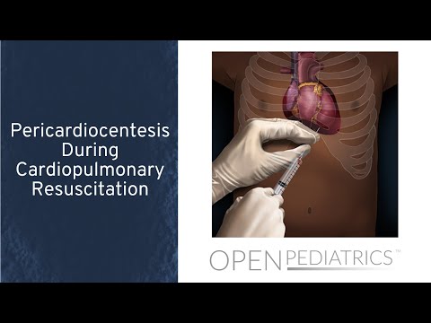 "Pericardiocentesis During Cardiopulmonary Resuscitation" by Dr. Traci Wolbrink for OPENPediatrics