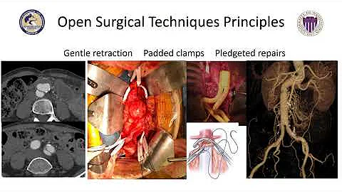 Surgical Interventions in Ehlers-Danlos & Patient ...