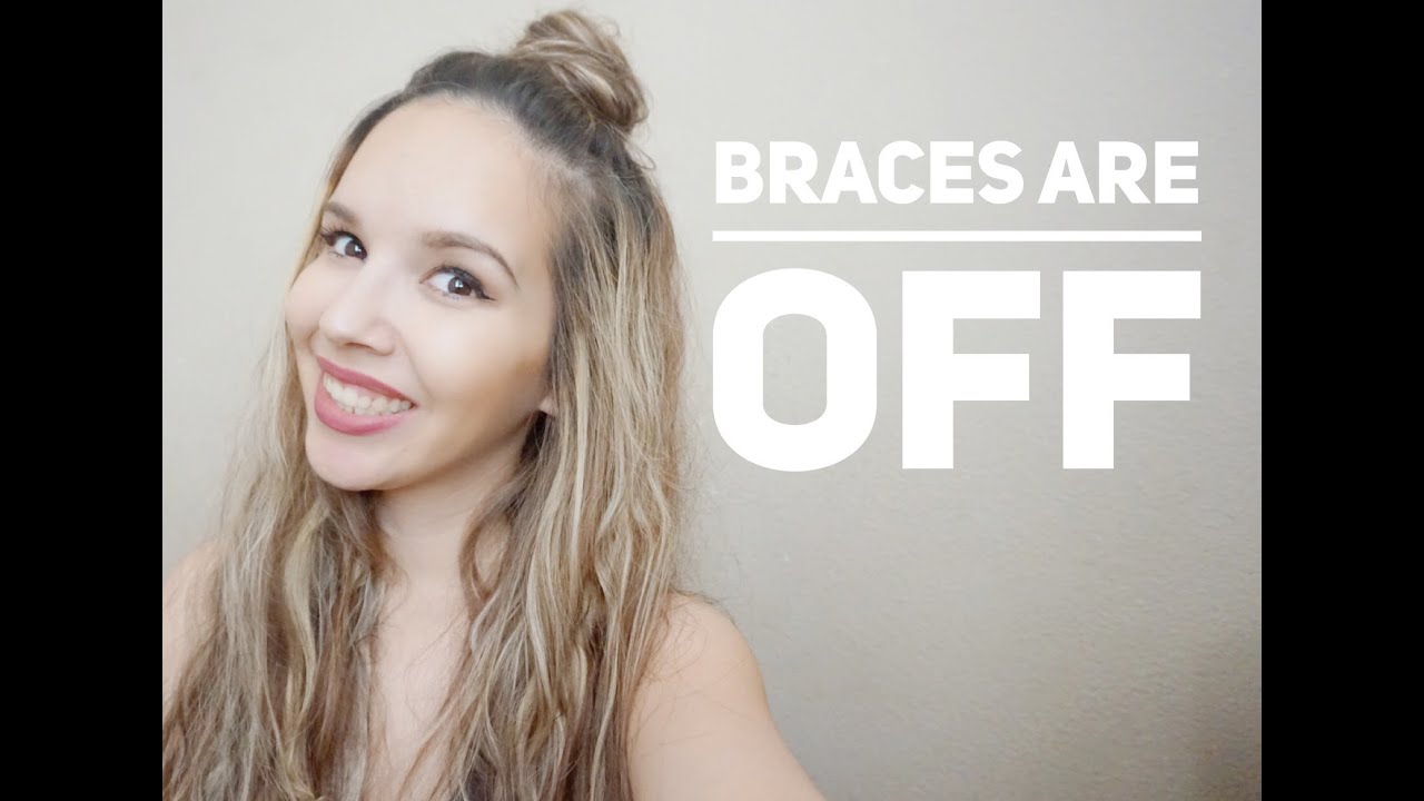 I'm braces free | My retainers | Ortho update