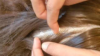 "Unlock Ultimate Relaxation: ASMR for Deep Sleep Bliss 🌙✨"