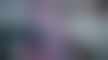 Flanged haptic intrascleral haptic fixation (Yamane technique)