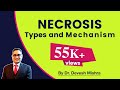 Necrosis , Types and Mechanism- General Pathology