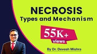 Necrosis , Types and Mechanism- General Pathology