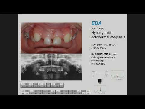 Video: Nucleotid-Polymorphismus-Assay Zur Identifizierung Der Westafrikanischen Gruppe Bacillus Anthracis: Eine Linie Ohne Anthrose