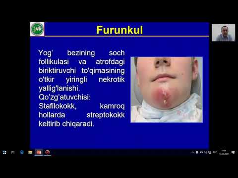 Video: Ushbu hidrofil va hidrofobik atamalar nimani anglatadi va ular qanday bog'liq?