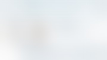 Restricted Kinematic Alignment TKA - with Personalized Instruments