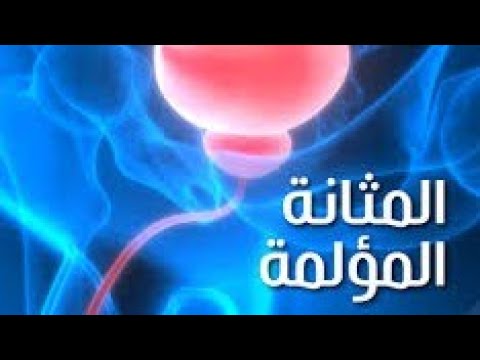 التهاب المثانه الخلالي ( المثانه المؤلمه)