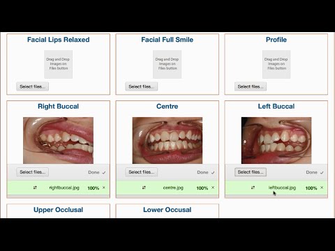 Digital Orthodontic Intra-Oral scanned Submission to our Portal