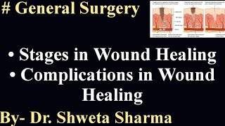 SURGERY- WOUNDS HEALING-Stages of Wounds Healing & Complications Of Wound Healing, Types of wounds