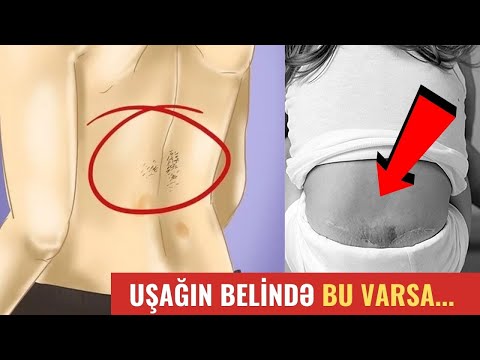 Video: İt itxanaları, Perm: icmal, xüsusiyyətlər, şərtlər və rəylər