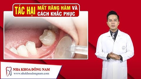 Tác Hại Của Việc Mất Răng Hàm Và Cách Khắc Phục | NHA KHOA ĐÔNG NAM®