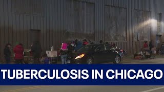 Tuberculosis cases confirmed at Chicago migrant shelters