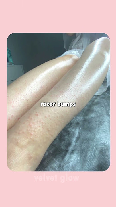 The Baby Oil Beauty Secrets You NEED! 💖✨#shortsviral