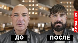 ZIMA  Борода иди сюда | Пластика в Турции | Пересадка волос | Курбан Омаров влог