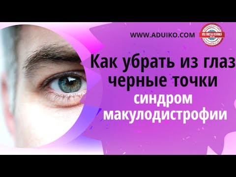Как убрать из глаз черные точки – синдром макулодистрофии