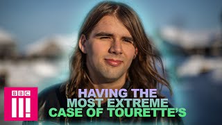 I Have the Most Extreme Case of Tourette