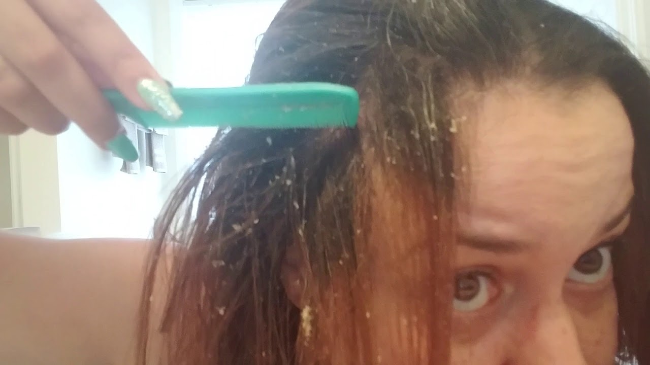 ASMR Scratching my scalp psoriasis with a comb. Scratching noises