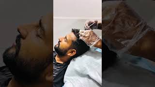 Hair PRP Treatment For Hair Fall and hair loss #drzunairmunir #trending #ytshorts #foryou #fypシ