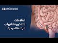 العلامات التحذيرية لالتهاب الزائدة الدودية